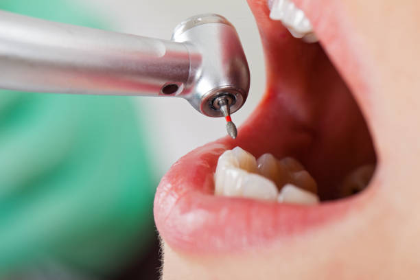 Best Broken or Cracked Tooth Emergency Dentist in Oaklyn, NJ